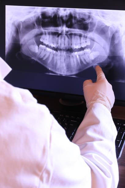 Best Emergency Dental Filling Replacement  in Frankfort, OH