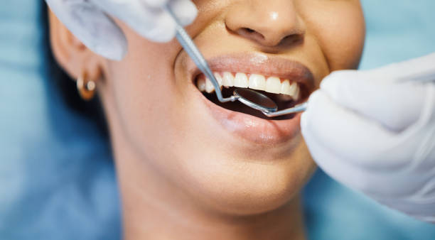 Best Dentist for Severe Toothache  in Frankfort, OH