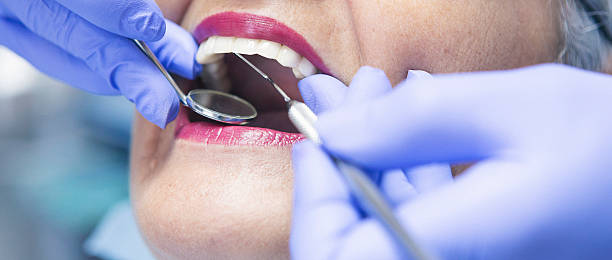 Best Teeth Whitening  in Frankfort, OH