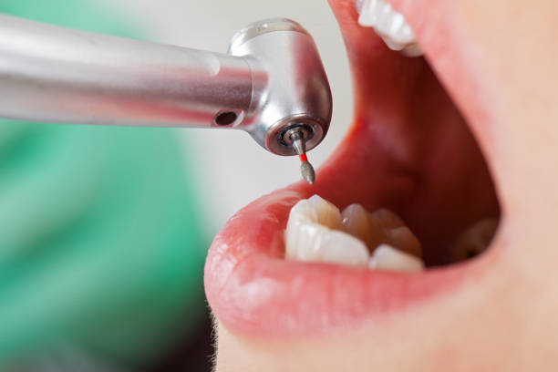 Best Tooth Infection Emergency Dentist  in Frankfort, OH